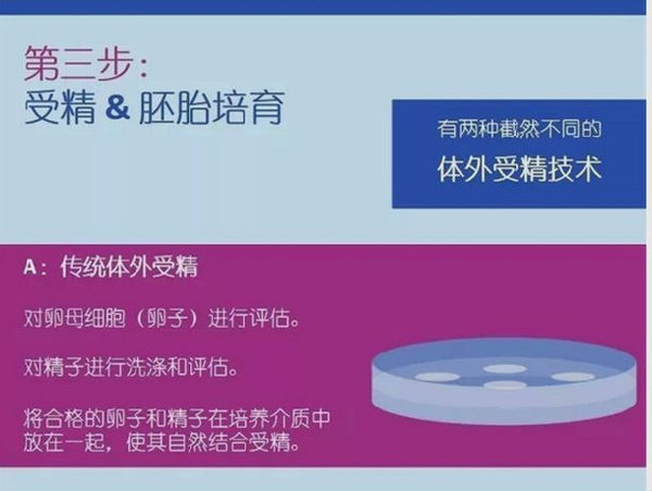 辅助生殖技术流程_格鲁吉亚试管婴儿费用_试管婴儿技术