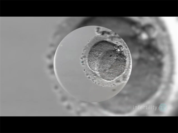 格鲁吉亚试管生龙凤双胞胎价格_格鲁吉亚试管婴儿费用_格鲁吉亚试管取卵手术