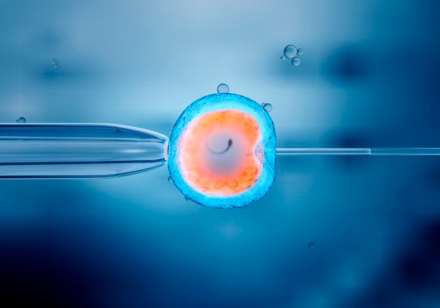 格鲁吉亚助孕专家_格鲁吉亚试管婴儿前期准备要点_格鲁吉亚试管婴儿流程管理